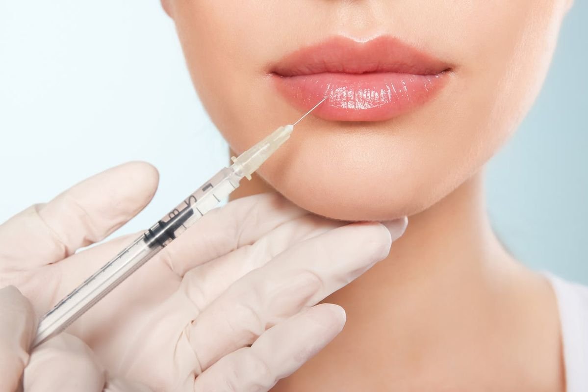 Buy Revanesse Lips Online