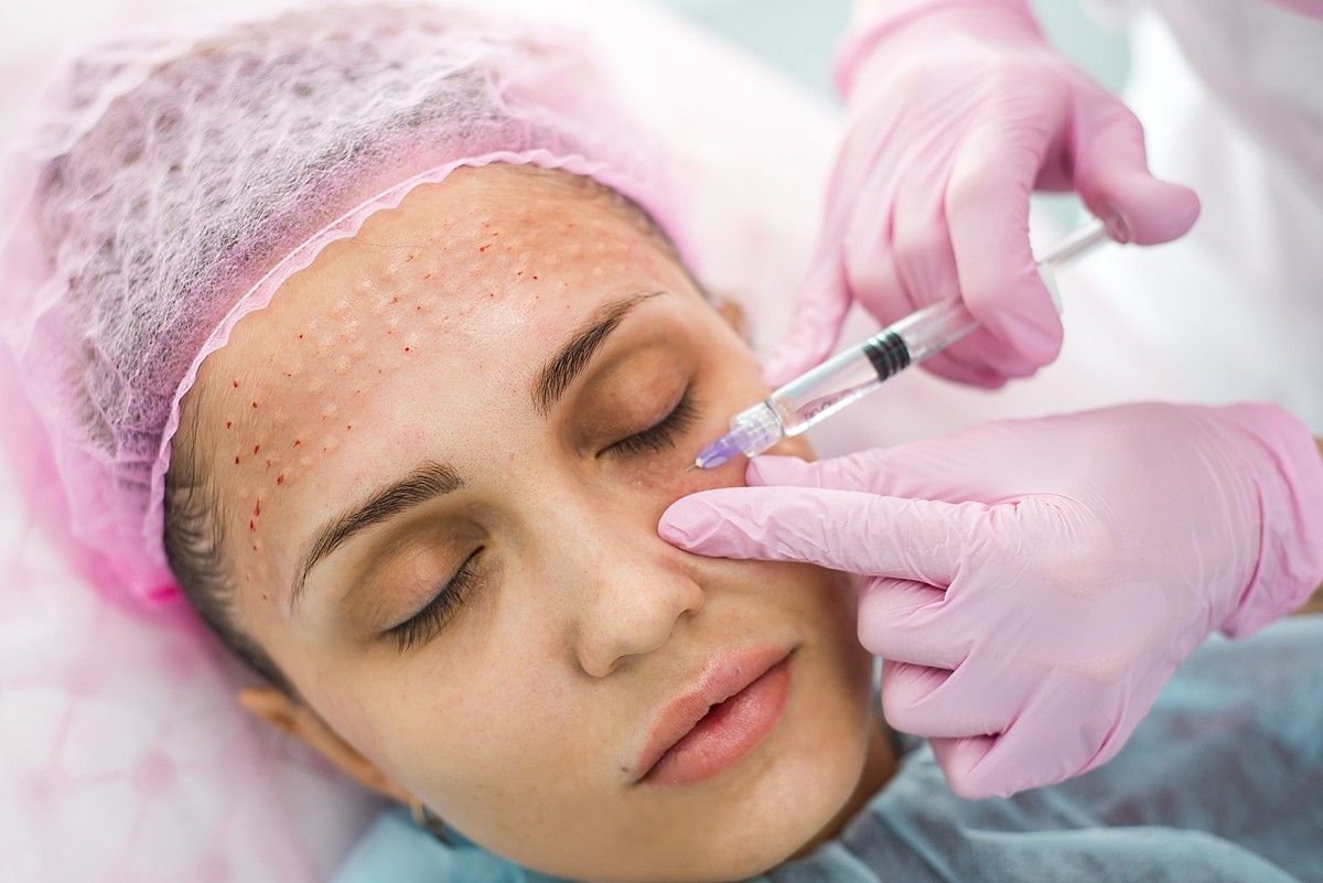 Buy Botox and Fillers Near Me Online