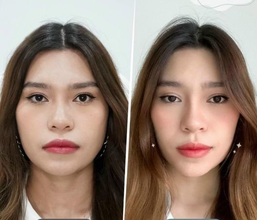 Buy Masseter Botox Wholesale for Professional Jaw Reduction Treatments