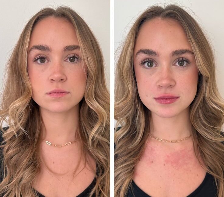 Botox Kosten vergleichen